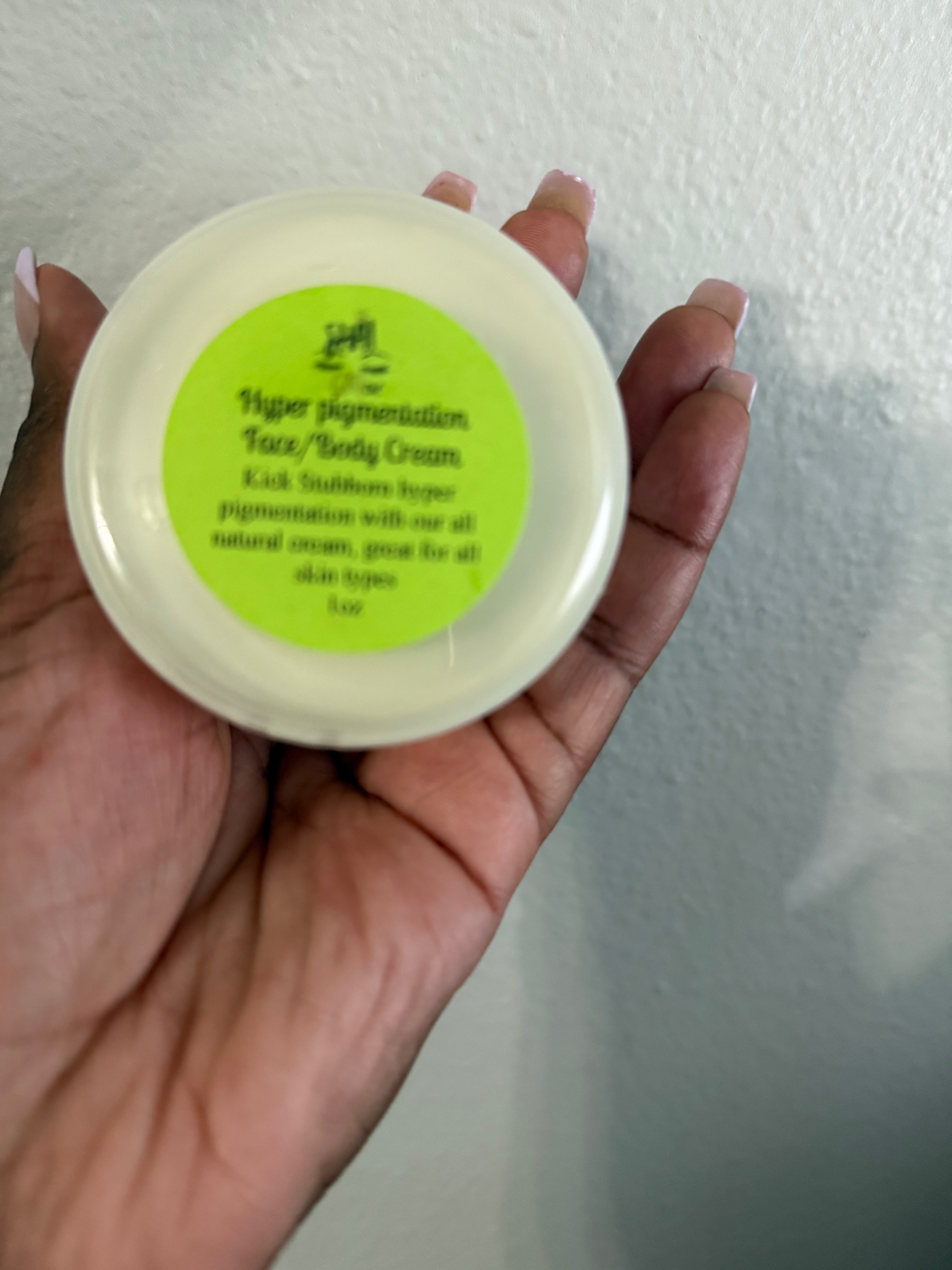 Hyperpigmentation