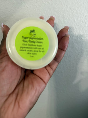 Hyperpigmentation
